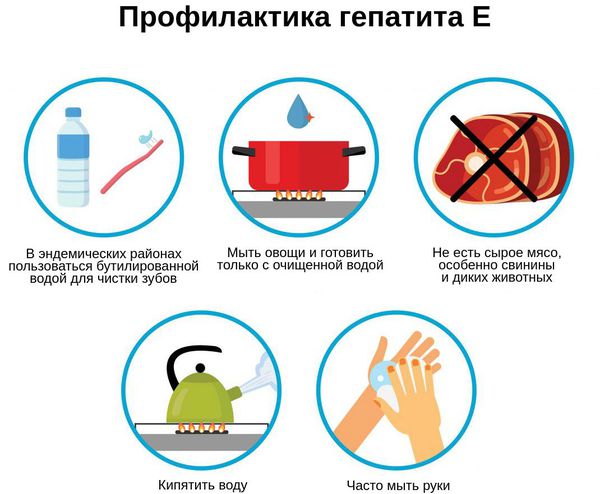 Вирусный гепатит Е. Вирусный гепатит Е.